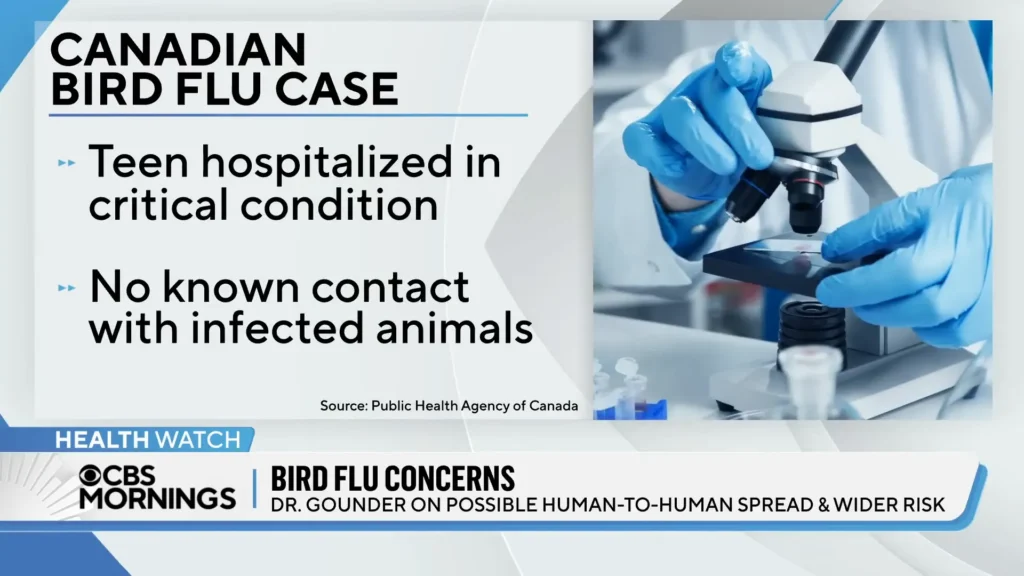 bird flu